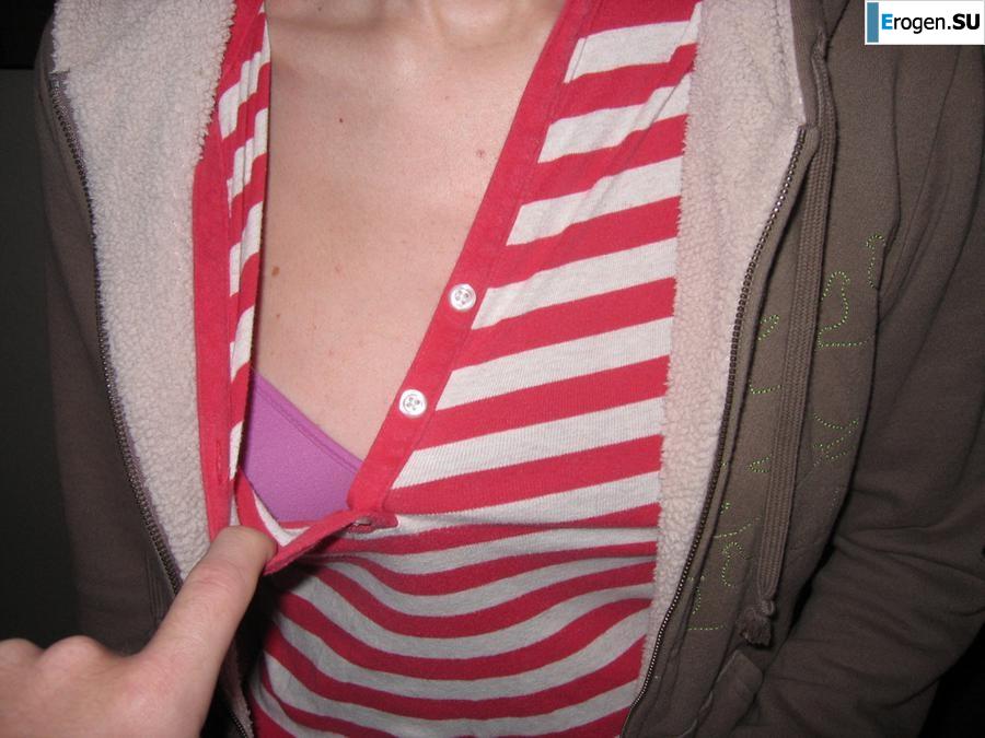 On the face of a terrible, kind inside. Photo 10