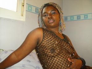 nigra. Part 2. Thumb 10