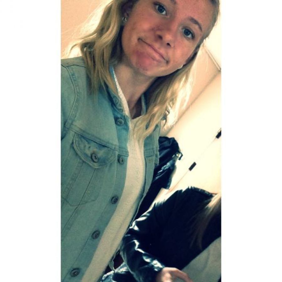 Acne selfie. Photo 31